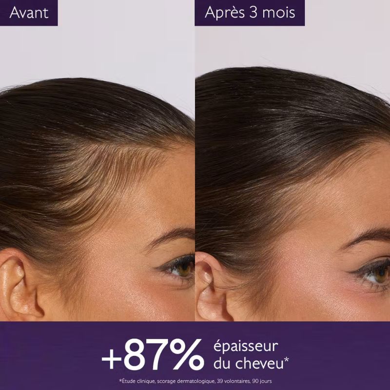 résultats Caudalie serum chute